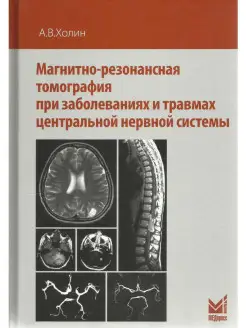 Магнитно-резонансная томография при забо