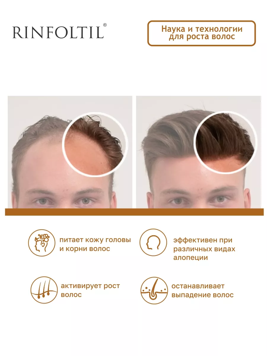 Сыворотка для волос от облысения для мужчин Активатор роста Ринфолтил  8886570 купить за 1 655 ₽ в интернет-магазине Wildberries